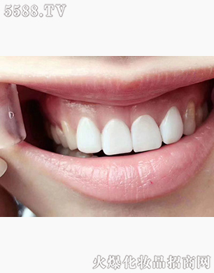 ���(y��ng)������Ӗ(x��n)����