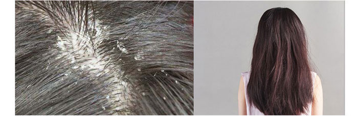 茶氏家族-古樹山茶麩洗發(fā)乳 茶氏家族-古樹山茶麩洗發(fā)乳