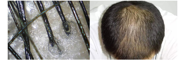 茶氏家族-古樹山茶麩洗發(fā)乳 茶氏家族-古樹山茶麩洗發(fā)乳