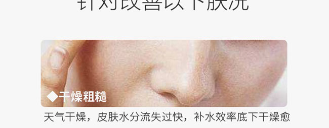 �C��ѩ�wõ�����ױ���Ħ��