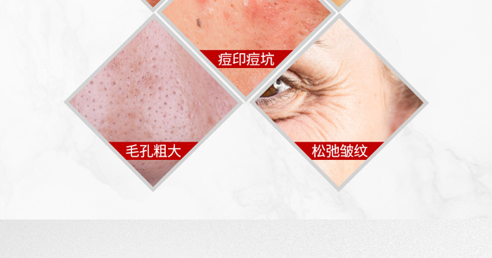 ������Ҽ������o(h��)���ɷ�+�������o(h��)��ýҺ