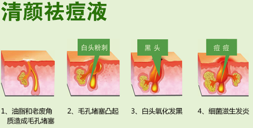 ��������